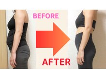 りそう整骨院 豊中蛍池院/Before After
