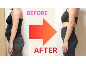 りそう整骨院 豊中蛍池院/Before After