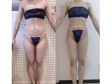 パピヨン(Papillon)/全身サイズダウン◎