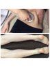 【夏の特別コース】全身痩身＋ひざ下 or ひじ下 脱毛 23000円→18000円