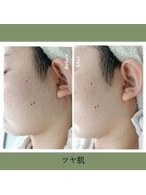 ノト(NOTO)/ツヤ肌シェービング