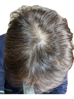 リセル(Recell)/育毛促進ケア