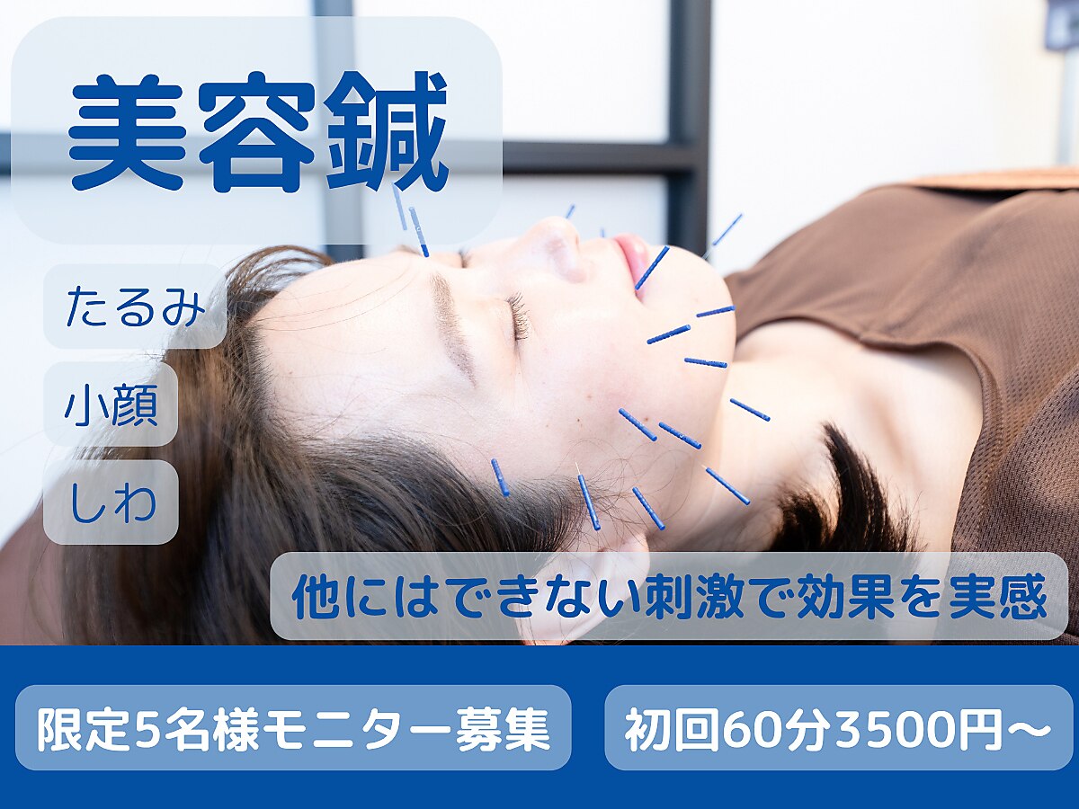 そよな はり灸整骨院｜ホットペッパービューティー