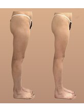 ラディアンス/下半身コース