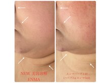 ラウレア(Laule'a)の雰囲気（最新の美容溶解でたるみを改善しリフトアップ◎岡山/津山）