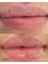 トゥジュール(Toujours)/リップエステ