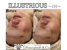 デマントイド 倉敷(Demantoide&Co)/クリスティーナイラストリアス