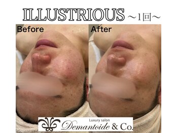 デマントイド 倉敷(Demantoide&Co)/クリスティーナイラストリアス