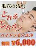 【男性】【毛穴ごっそりリセット】ハイドラ毛穴洗浄＋光フェイシャル ￥6,000
