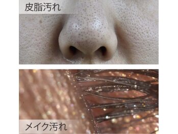 イーズ(ease)の写真/毛穴のつまり、ザラつきをケアしてつるつる肌に♪化粧ノリも良くなり、理想の肌へ！