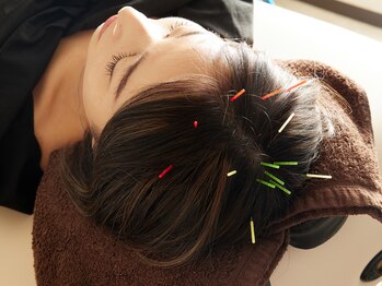 ジーブ(jeebu)/鍼灸★美容鍼★小顔★ヘッドスパ