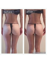 トータルビューティサロン リボーテ(Re:Beaute)/美尻形整