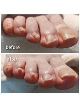 爪切り屋 足楽/爪ケア40分