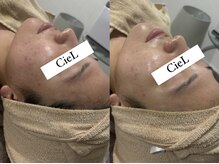 シエル(CieL)/結果重視のサロンです！