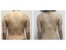 【ダイエットモニター募集】インディバ90分×10回　毎回写真どり必須　2部位
