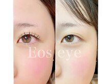 エオス(Eos)
