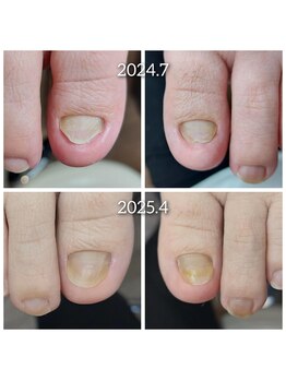 爪切り屋 足楽/