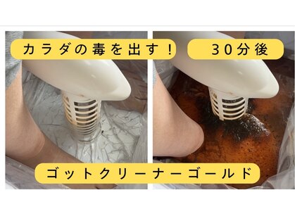エイチツーアイ(H2eye)の写真