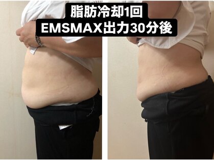 スリム(SLIM by lily of the valley)の写真