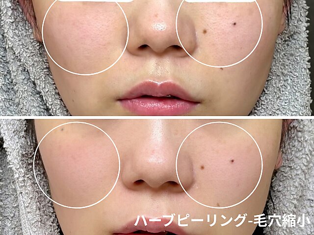 アンナビューティ 六本木 乃木坂店(Anna Beauty)｜ホットペッパー