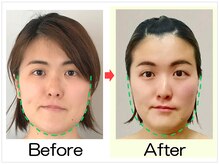 小顔矯正エステ プリュムレーヴ