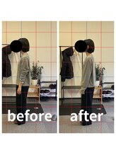 熊本カワル整体 JR上熊本駅院/首の痛み