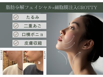 ワイビューティ(Y.Beauty)の写真