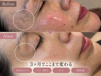 スウィート 矢場町店(Sweet)の写真