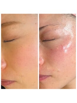 ココリ(CoCoRe)/Hy peel into