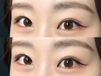 ヨーク トゥルペ(yorke tulpe)の写真/モチにお悩みの方必見♪お客様の個性に合わせた施術で、憧れのお目元をしっかり叶えます☆