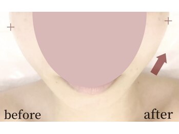 ガーデン(Garden)/滋賀彦根/たるみ改善専門Garden