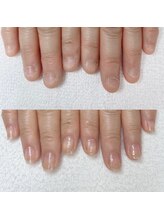 エン(en)/最強のネイルケアコース