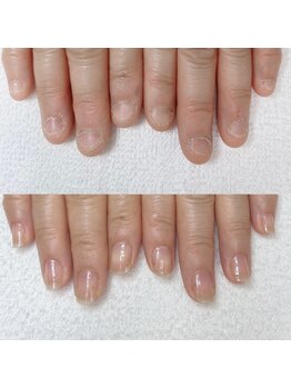 エン(en)/最強のネイルケアコース