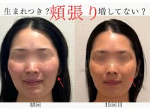 エレミュー 烏丸(Elemue.)の雰囲気（★食いしばりからの顔悩みしっかり改善★）