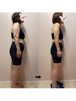 にこ鍼灸治療院/55歳　3ヶ月で12kg達成。