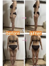 サロンデュヒャーク 志木駅前店(salon du ひゃーく)/症例写真【痩身】