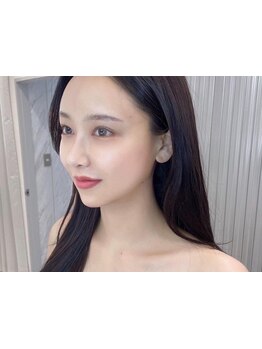 美白ケアをしたい