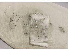 モデルズ(MODELS)の雰囲気（1回で抜けるヒゲの量。本物だからできる技です。最短で卒業可能）