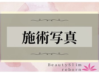 ビューティースリム リボーン 新宿店(reborn)/【施術写真】