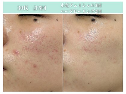 サンビ(SANBI)の写真