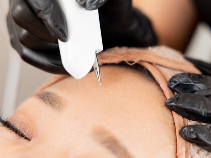 シトラ(CITRA)の写真