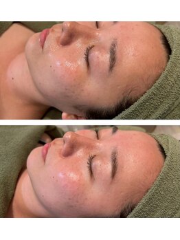 温凪 心斎橋(MINAGI)/ダクトピール