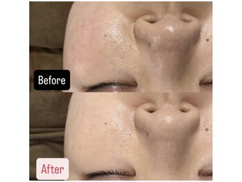 ハイコガオ 中崎町店(HIKOGAO)/ララピール