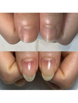 キュア(Cure.)/自爪育成ジェルネイルが人気!!