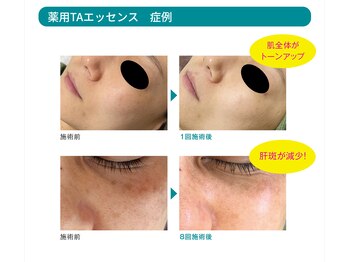 サロン アンネ(Anne)/