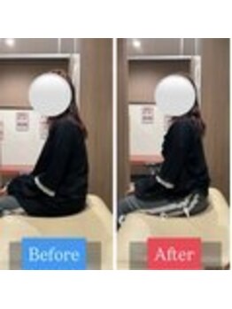 ナオル整体 宮崎院(NAORU整体)/20代女性施術事例【姿勢改善】