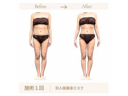 リスキン(Re:Skin)の写真
