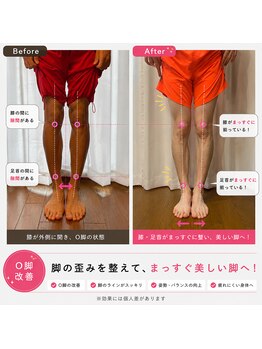 ふみらぼ 亀有/O脚スッキリ 美脚整体