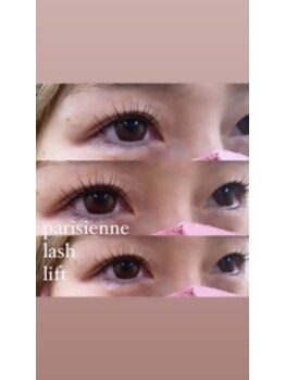 リンクス(links)/パリジェンヌラッシュリフト