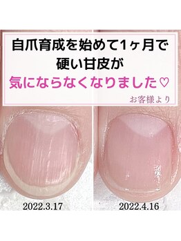 ミミ(mimi)/甘皮が気にならなくなりました！